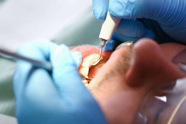 Best Weekend Emergency Dentist in Cashion, OK