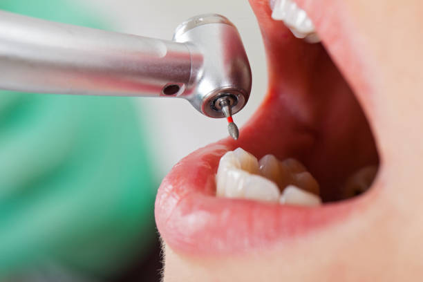 Best Urgent Care for Lost Fillings or Crowns in Cashion, OK